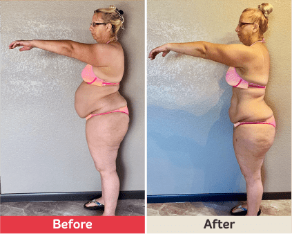 Before and after image.