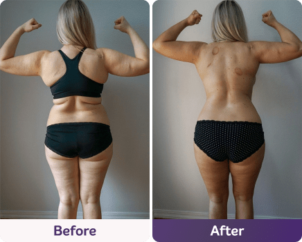 Before and after image.