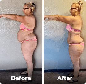 Before and after image.